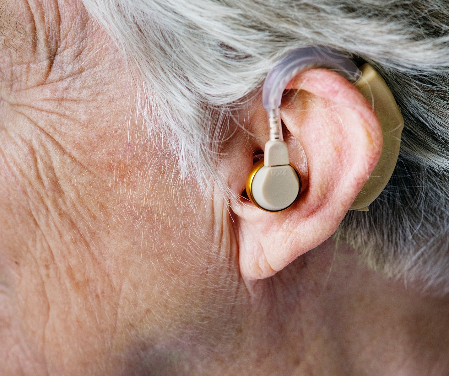 世界卫生组织：2050年全球1/4人口将不同程度“丢失听力”
